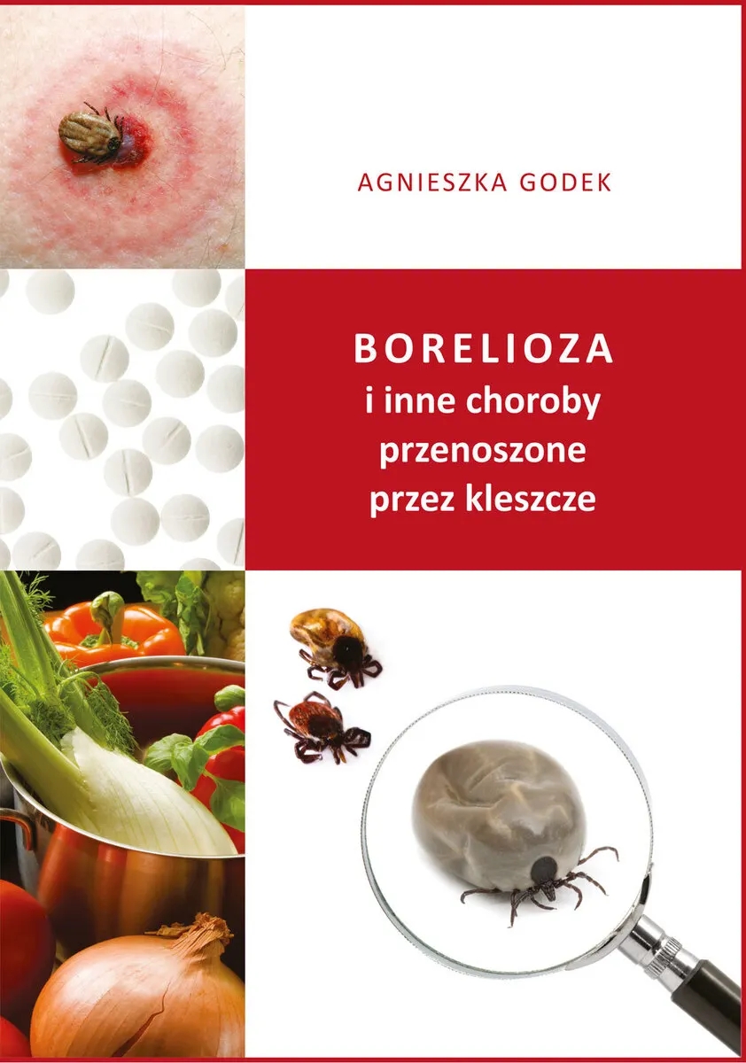 Borelioza i inne choroby przenoszone przez kleszcze 9788367036856